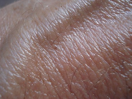 Surprising Truth About Skin Cancer - Just A Skin Issue